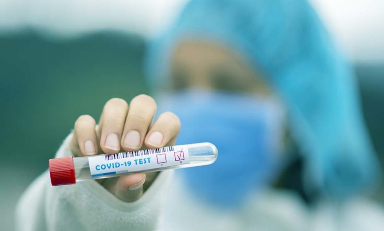 Anagni CORONAVIRUS: 96 attualmente positivi ad Anagni. L’appello del Sindaco: «Più prudenza» COVID