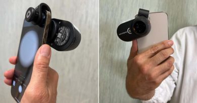Frosinone Asl Frosinone: via al progetto di teledermatologia per tumori maligni della cute TELEDERMATOLOGIA