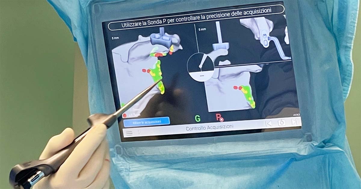 Cassino Innovativo intervento di chirurgia ortopedica all’ospedale di Cassino Intervento Ortopedico Cassino