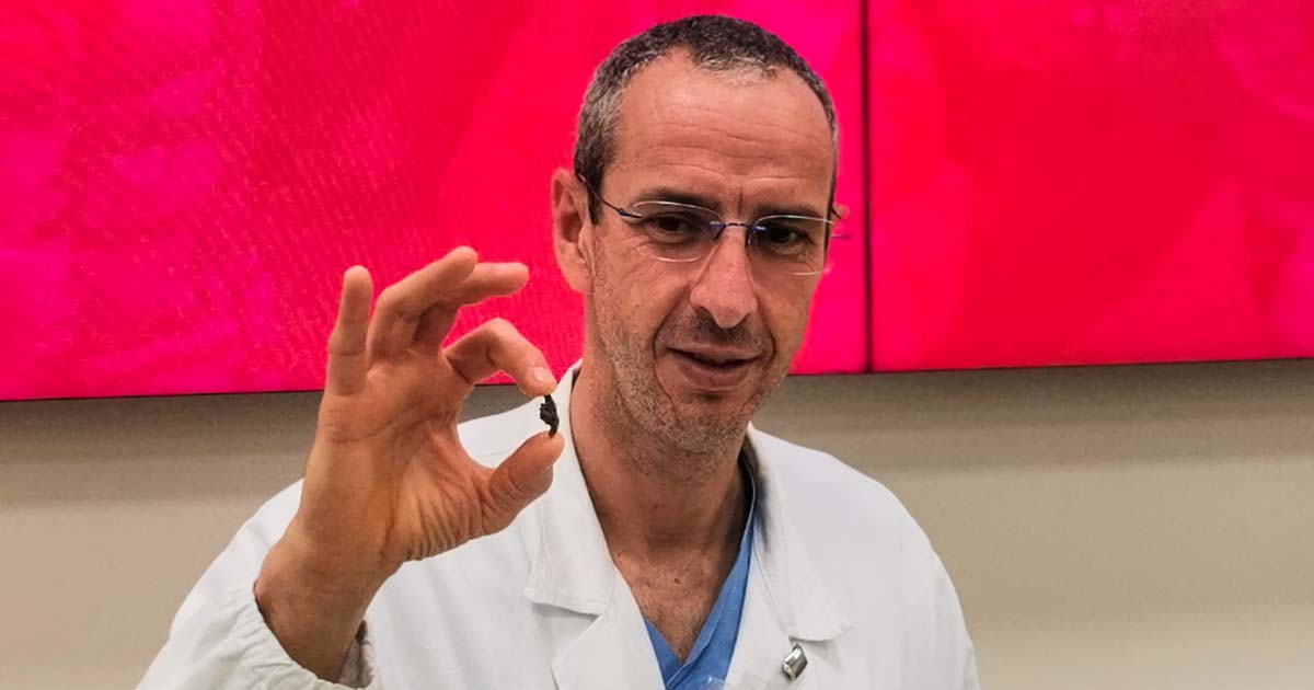 Scheggia di mortaio conficcata vicino al cuore: 11enne ucraino operato e salvato in Italia Ospedale Padova