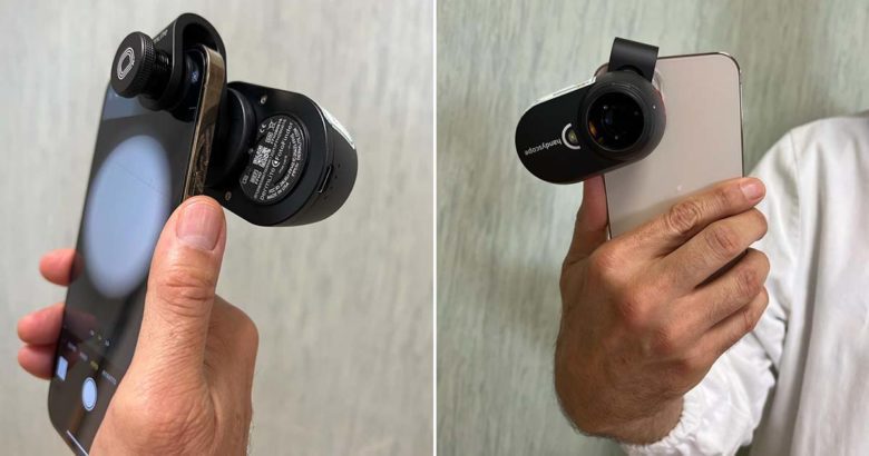 Frosinone Asl Frosinone: via al progetto di teledermatologia per tumori maligni della cute TELEDERMATOLOGIA